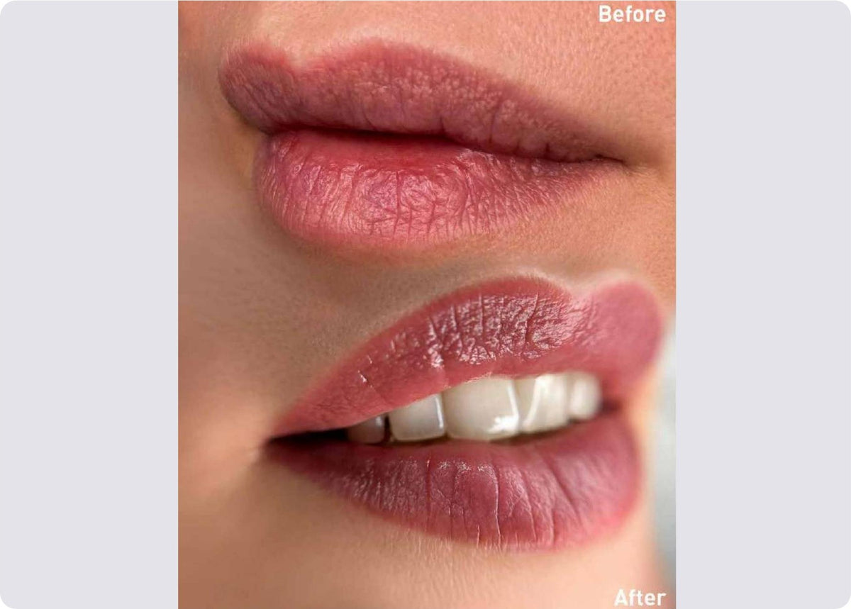 Amiea Evolutionline Nude Rose before and after lip blush results on a real client